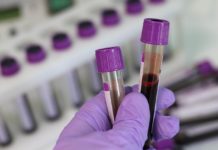 Nuevas enfermedades de transmisión sexual alertan a expertos Nuevas enfermedades de transmisión sexual alertan a expertos - Itagüí Hoy