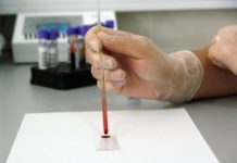 ¿Es posible hacerse la prueba del COVID-19 de manera particular?