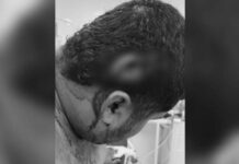 Mototaxistas fueron brutalmente golpeados por delincuentes en Santa Rosa de Osos