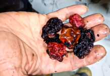 Al menos 40 familias resultaron intoxicadas por la quema de unos pimientos en Rionegro