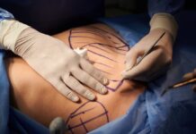 Fallece mujer tras complicaciones en procedimiento estético no autorizado en San Rafael