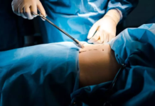 Alarma en Antioquia por 13 muertes a causa de cirugías estéticas ilegales en 2024