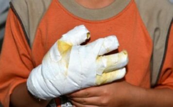 Niño de 10 años sufrió quemaduras por manipular ‘totes’ en Puerto Berrío; Antioquia llega a 197 lesionados